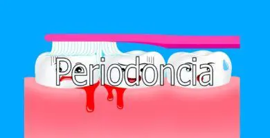 periodoncia