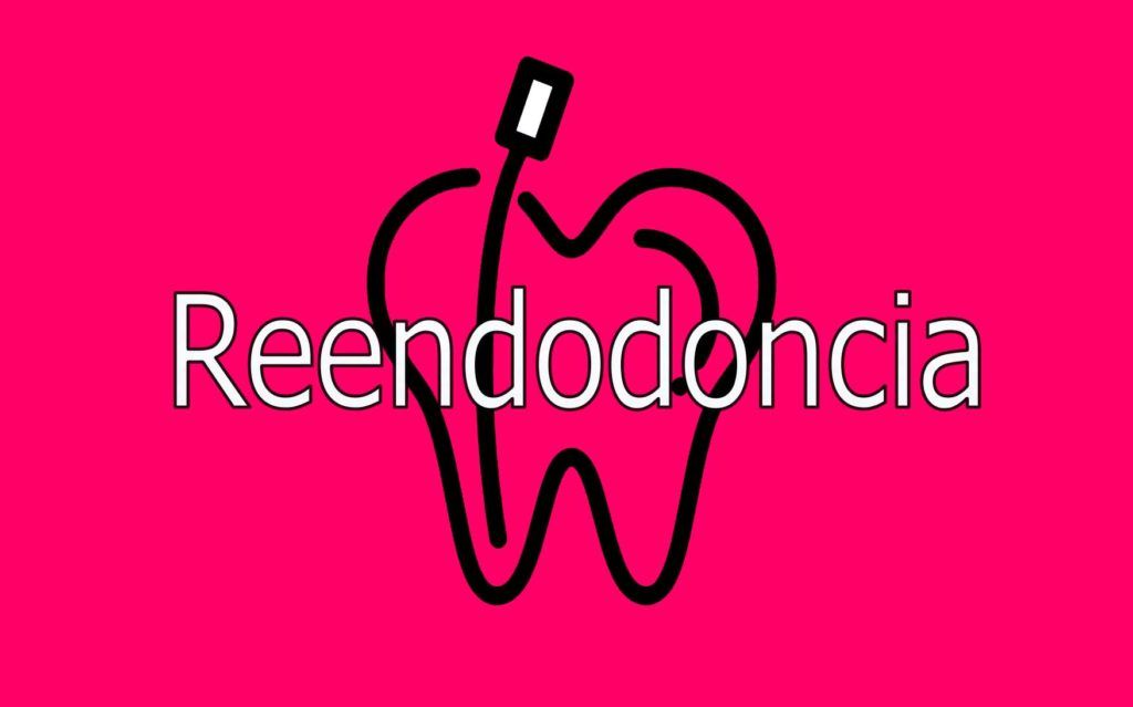 reendodoncia