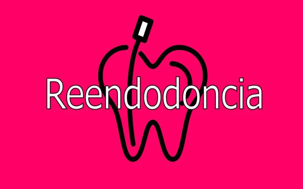 reendodoncia