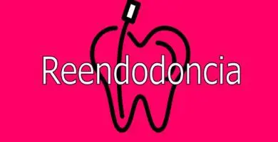 reendodoncia