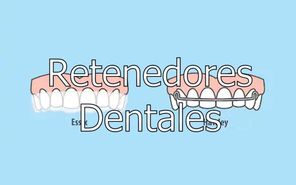 retenedores-dentales