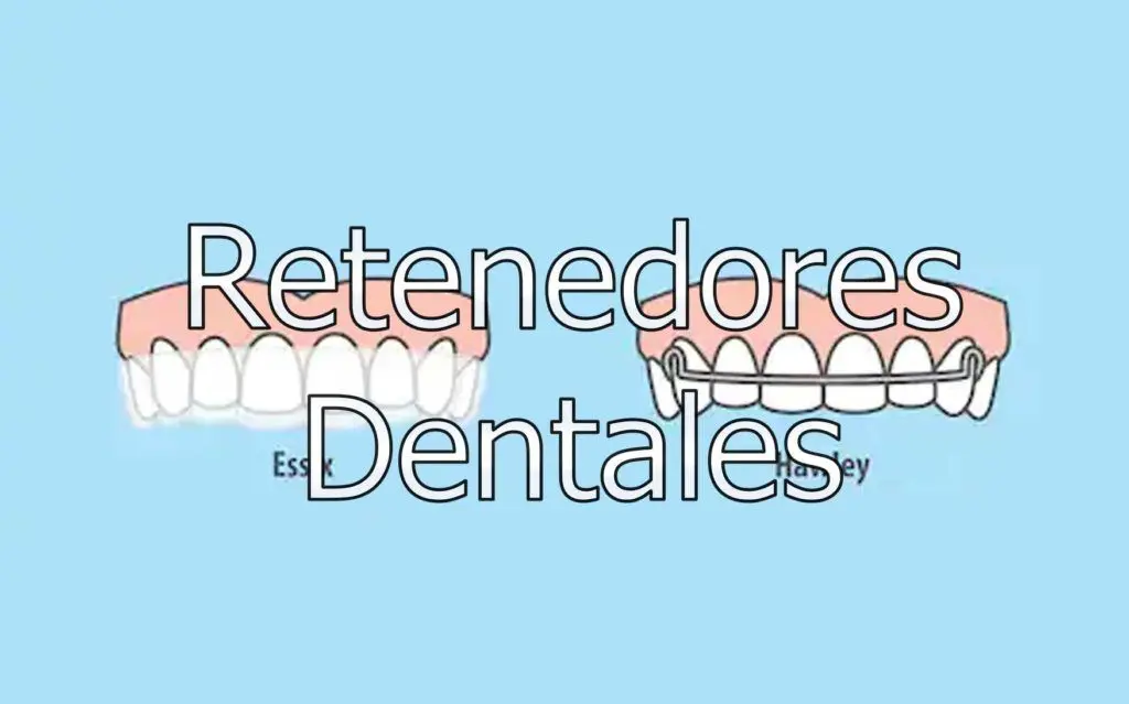 Retenedores dentales 9 retenedores-dentales