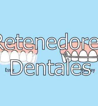 retenedores-dentales