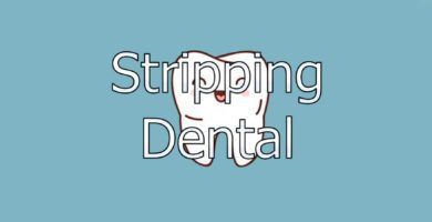 stripping-dental