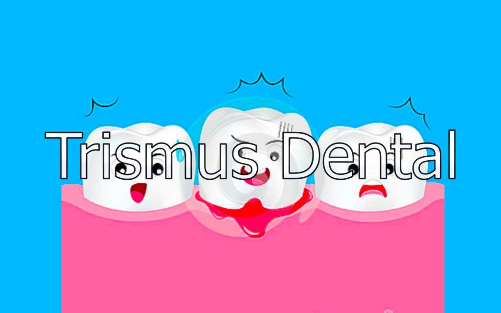 Trismus 1 trismus-dental