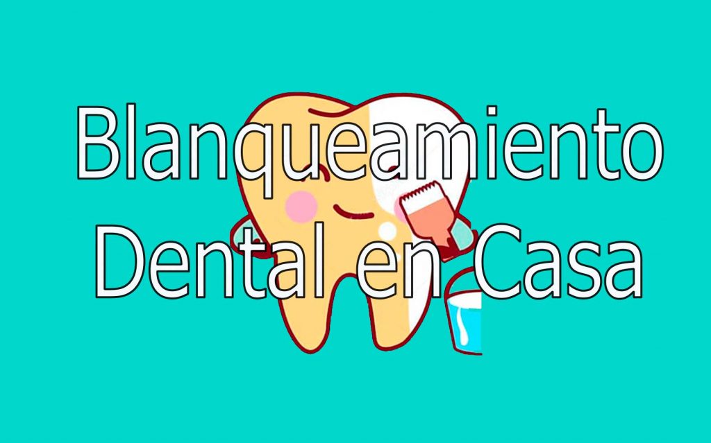 Blanqueamiento dental en Casa 1