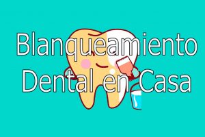 Blanqueamiento dental en Casa 2