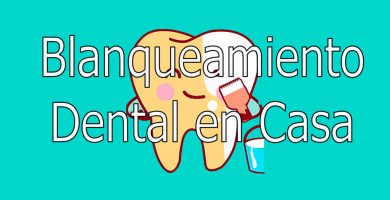 Blanqueamiento dental en Casa 4