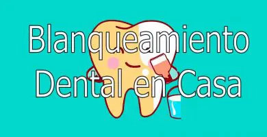Blanqueamiento dental en Casa 3