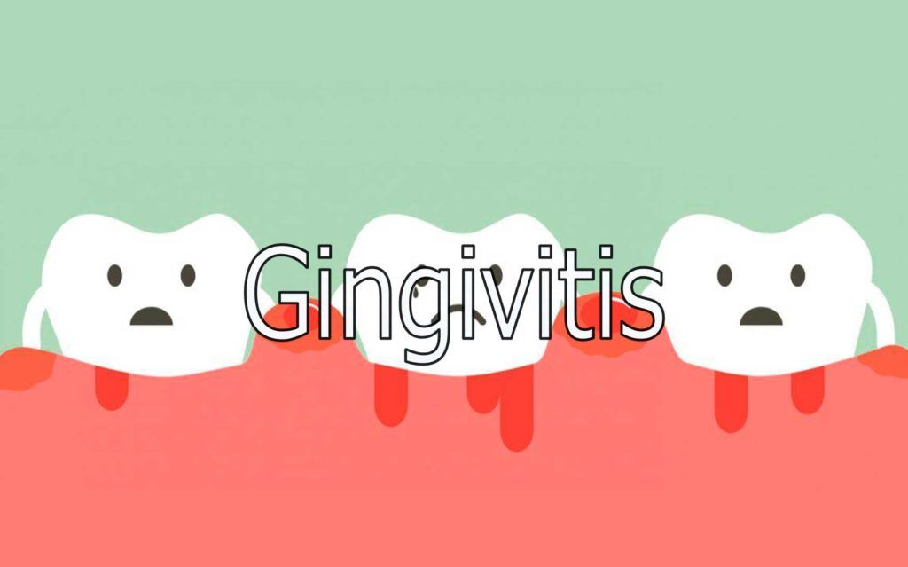 gingivitis