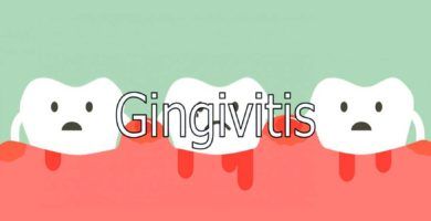 gingivitis